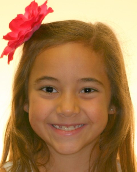 Young girl smiling before orthodontic treatment