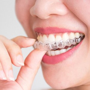Smiling patient placing aligners on top teeth