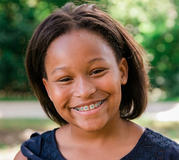 Orthodontist in Plano showing patient Invisalign aligner