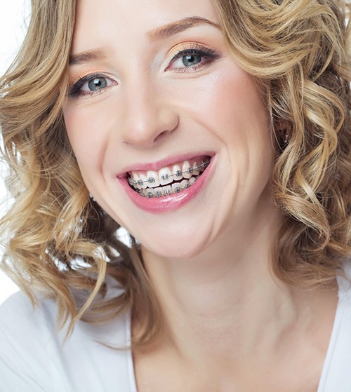 Portrait of blond adult woman smiling with braces