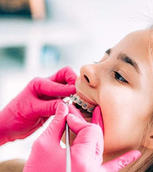 An up-close look at an orthodontist checking a patient’s teeth during a follow-up appointment