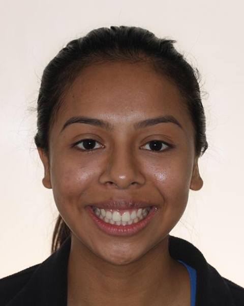 Preteen girl smiling after orthodontic treatment