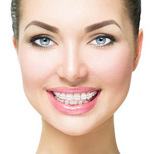 Portrait of smiling woman with clear braces in Plano