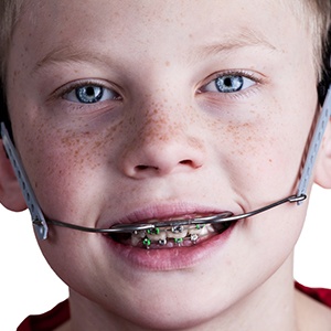 Young boy wearing dentofacial orthopedic headgear