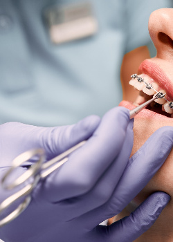 A man with custom braces