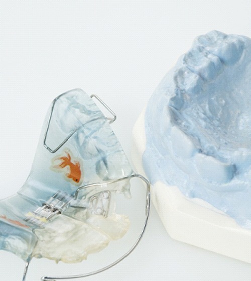 A posterior occlusal coverage retainer sitting next to a mouth mold in Plano