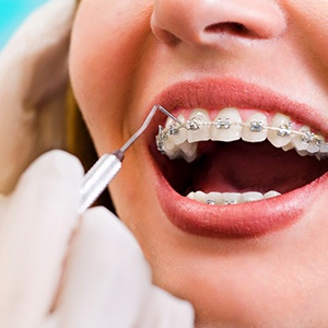 patient getting braces 