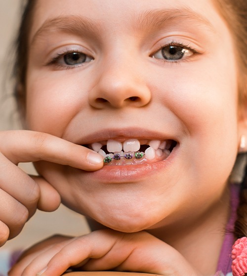 Child pointing to phase one pediatric orthodontics appliance on her teeth