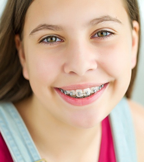 A young girl with traditional metal braces on her upper and lower teeth