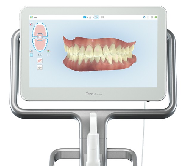 3 D images of bite on chairside computer