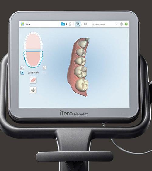 3 D scanner images of teeth and gums