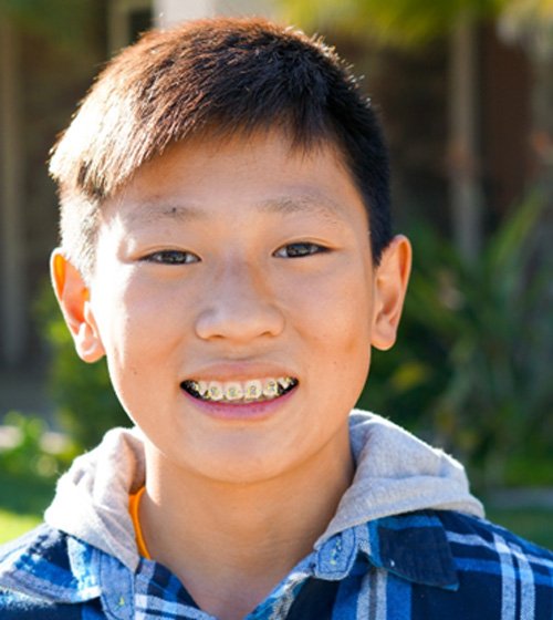 young boy smiling with braces