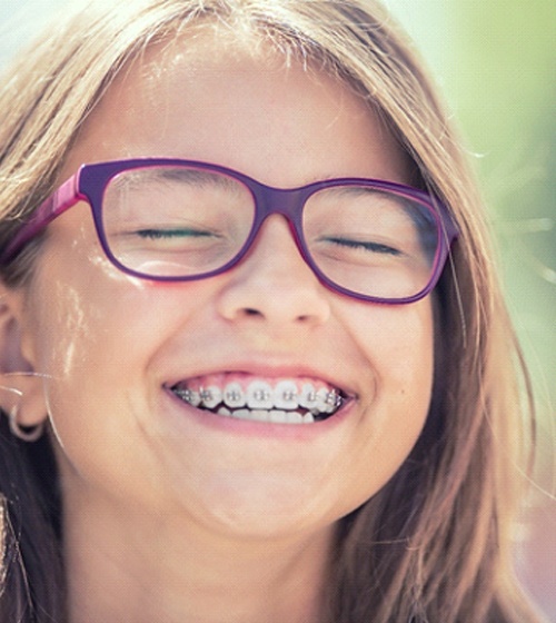 A young girl wearing purple glasses smiles while showing off her new braces recently placed by her orthodontist in Plano