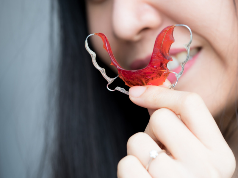 Patient switching their retainer