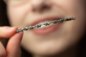 Person holding braces out in front of their face.